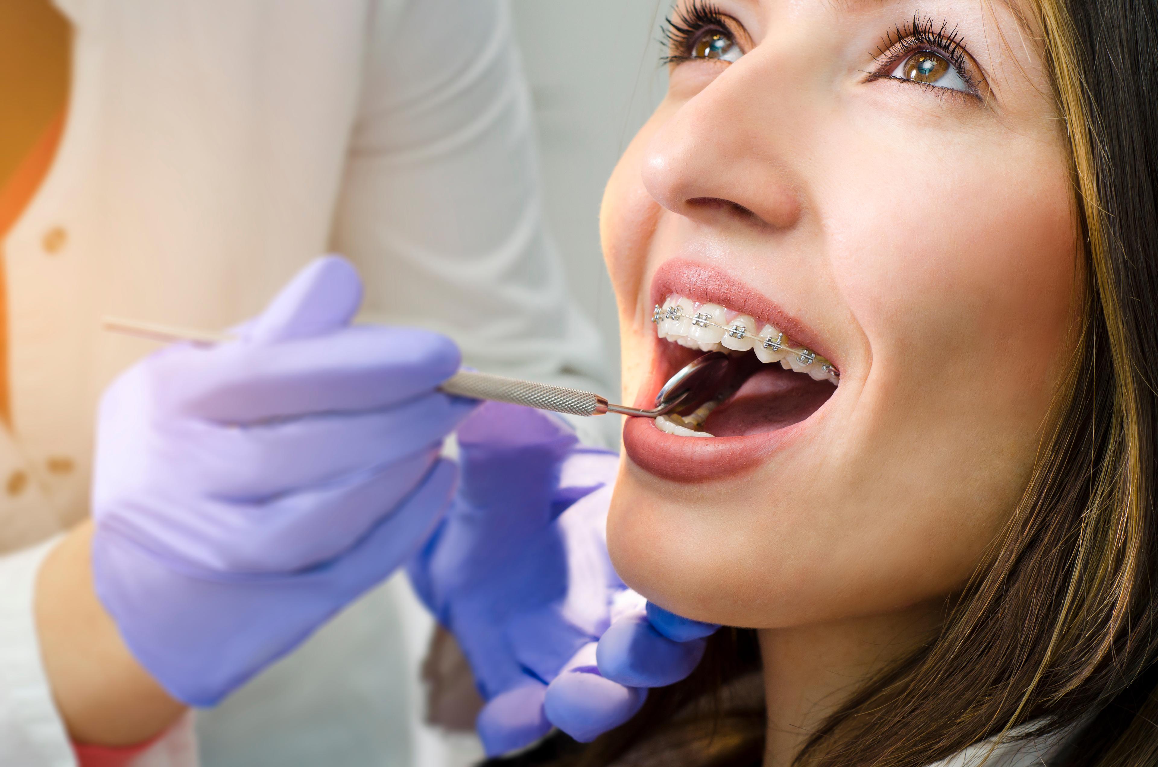 Close-up of a woman with metal braces on her teeth during an orthodontic appointment, with a dentist's gloved hand holding a dental mirror inside her mouth.